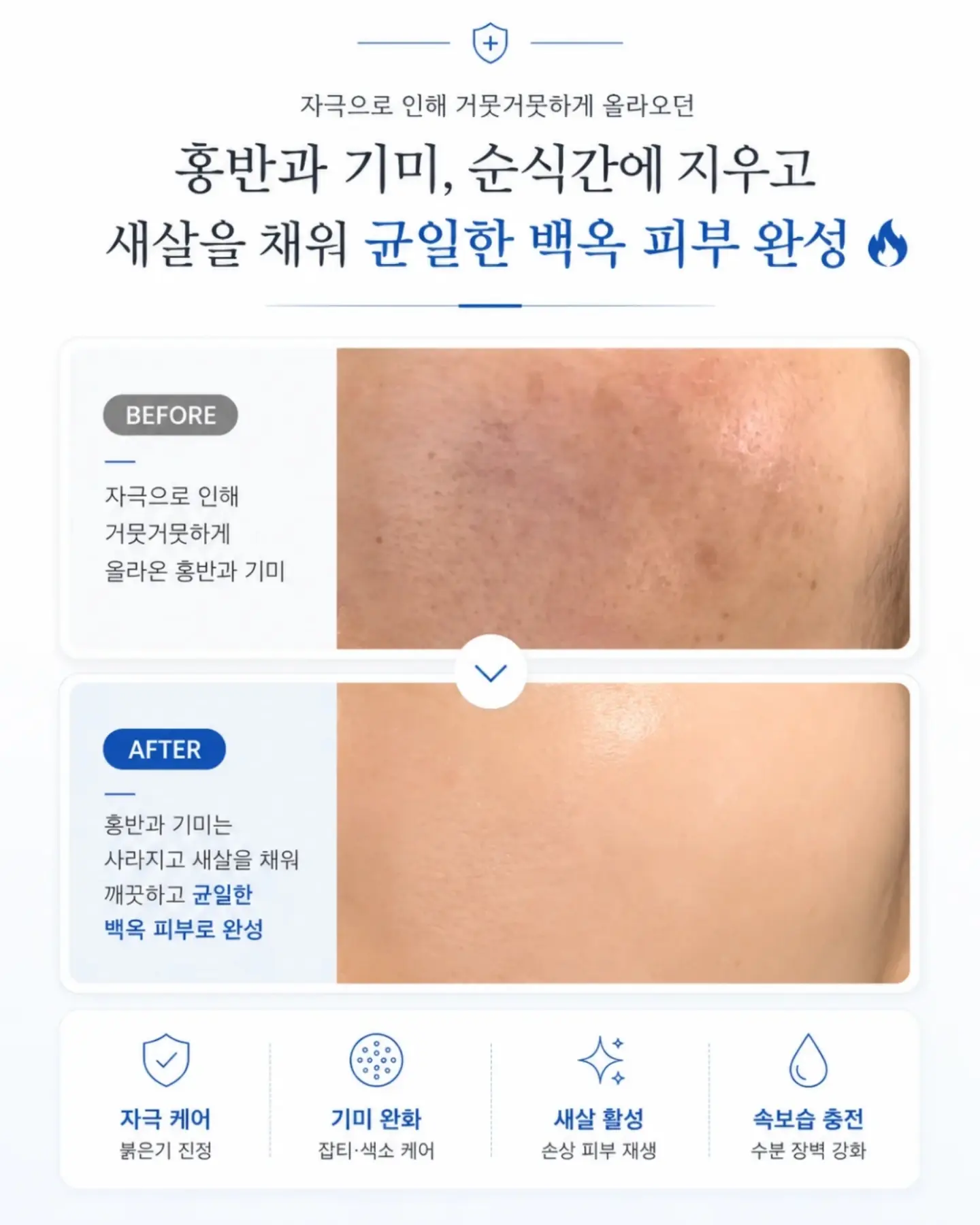 아티산 샌들 3