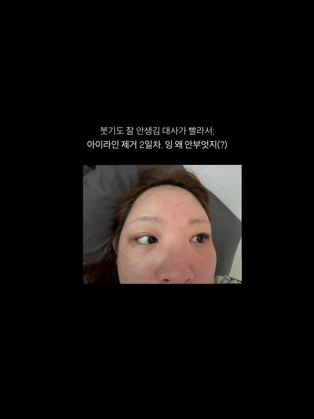 가스 용접기 3
