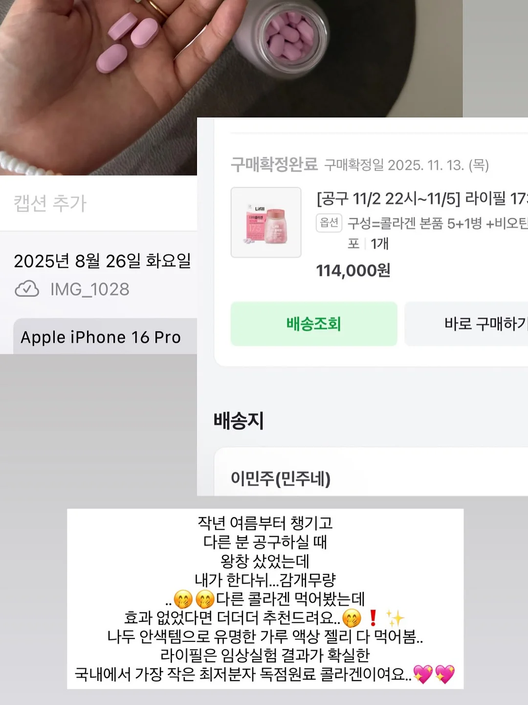 입술 문신 시술 16