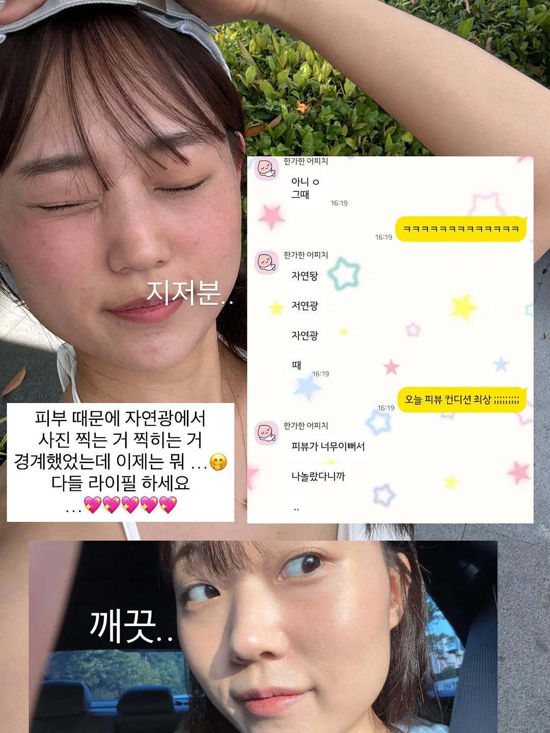 입술 문신 시술 2