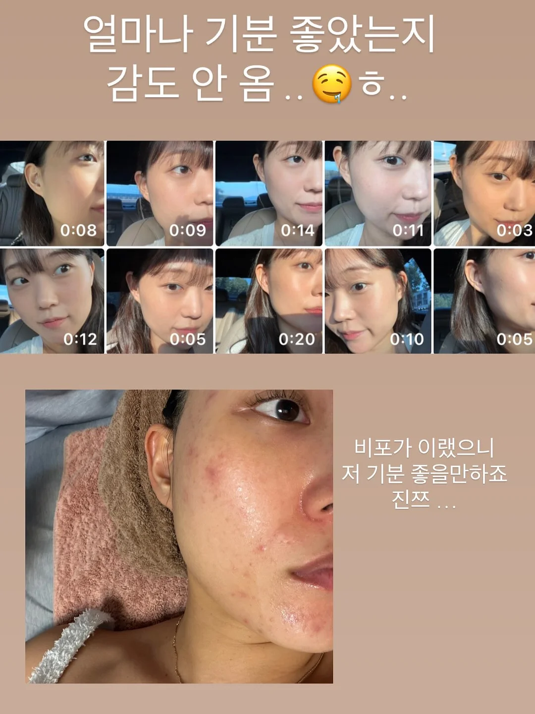 입술 문신 시술 3