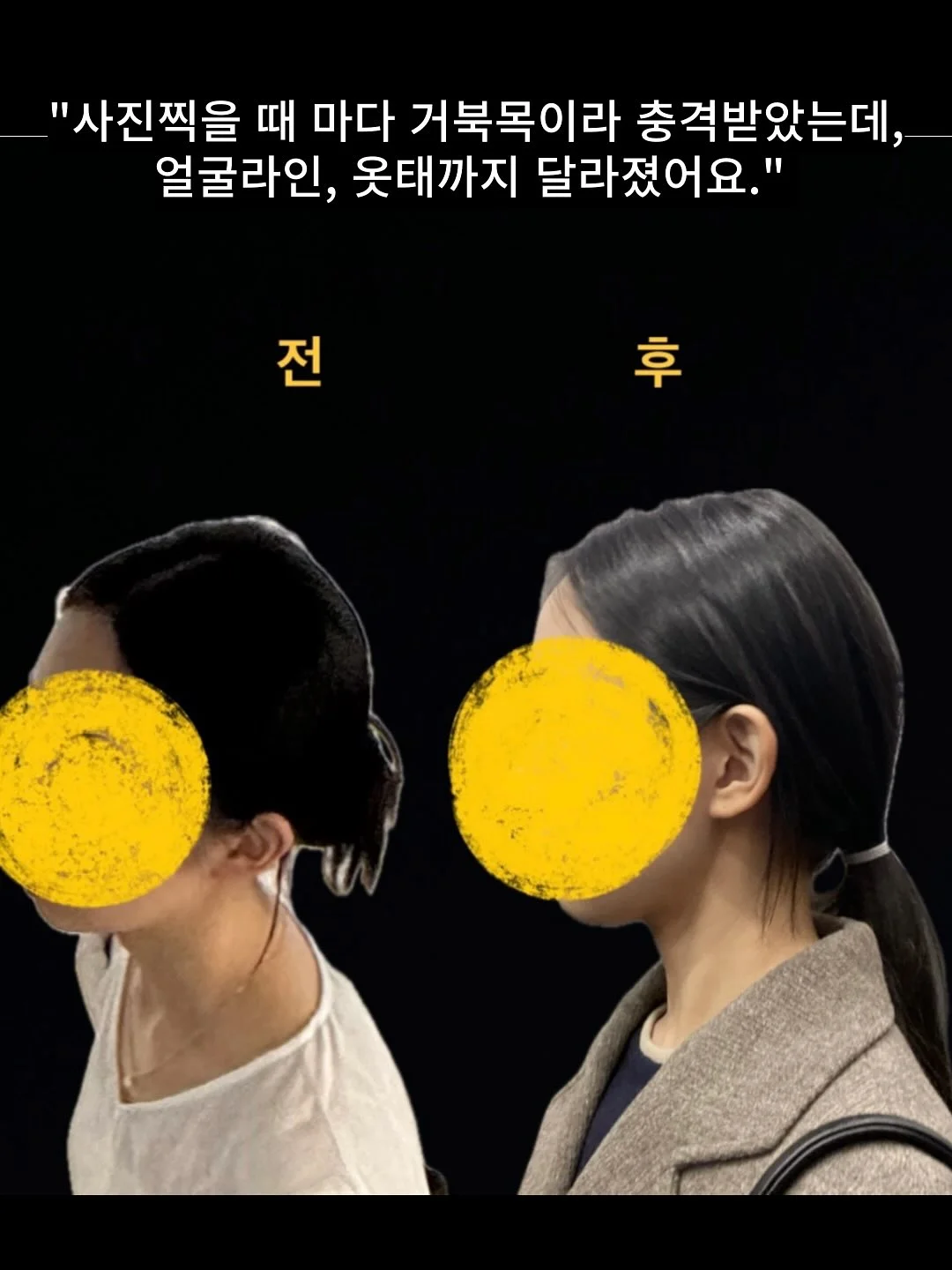주방싱크대 레일 선반 6