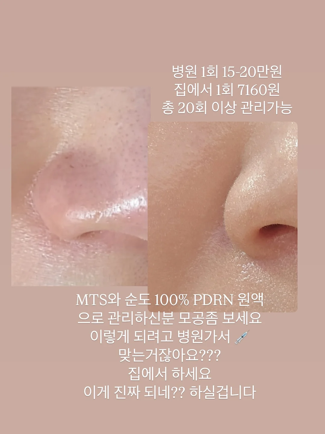 상세페이지 만들기 챌린지 2