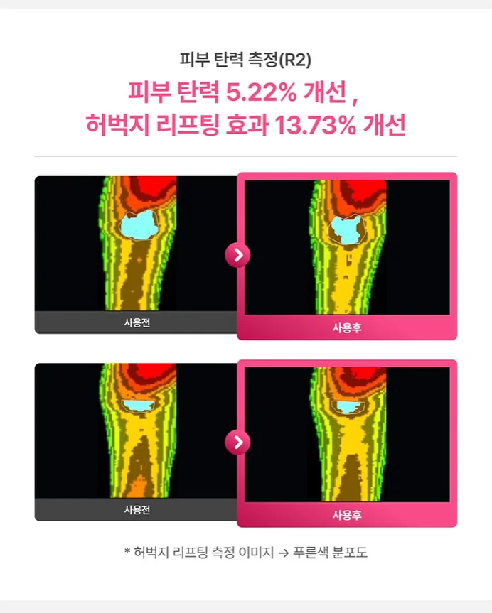 무늬 알리고무나무 14