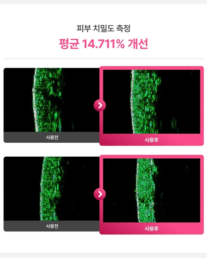 무늬 알리고무나무 15