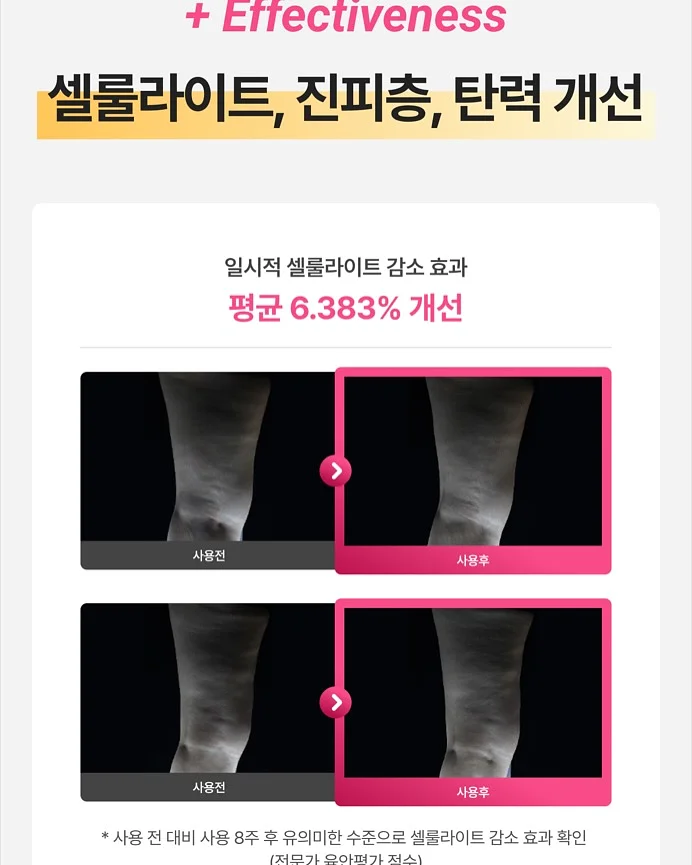 무늬 알리고무나무 17