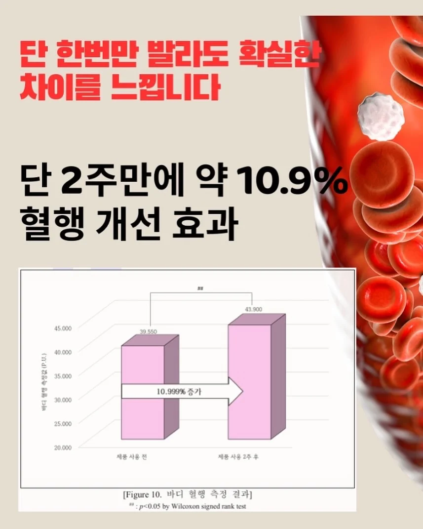 무늬 알리고무나무 5