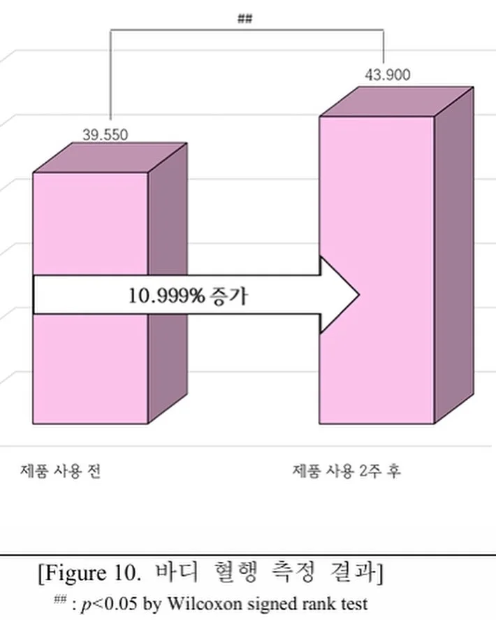 무늬 알리고무나무 6