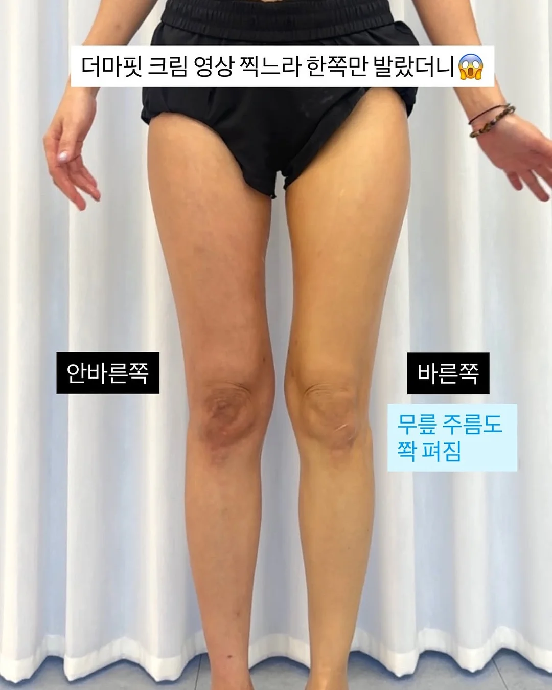 무늬 알리고무나무 9