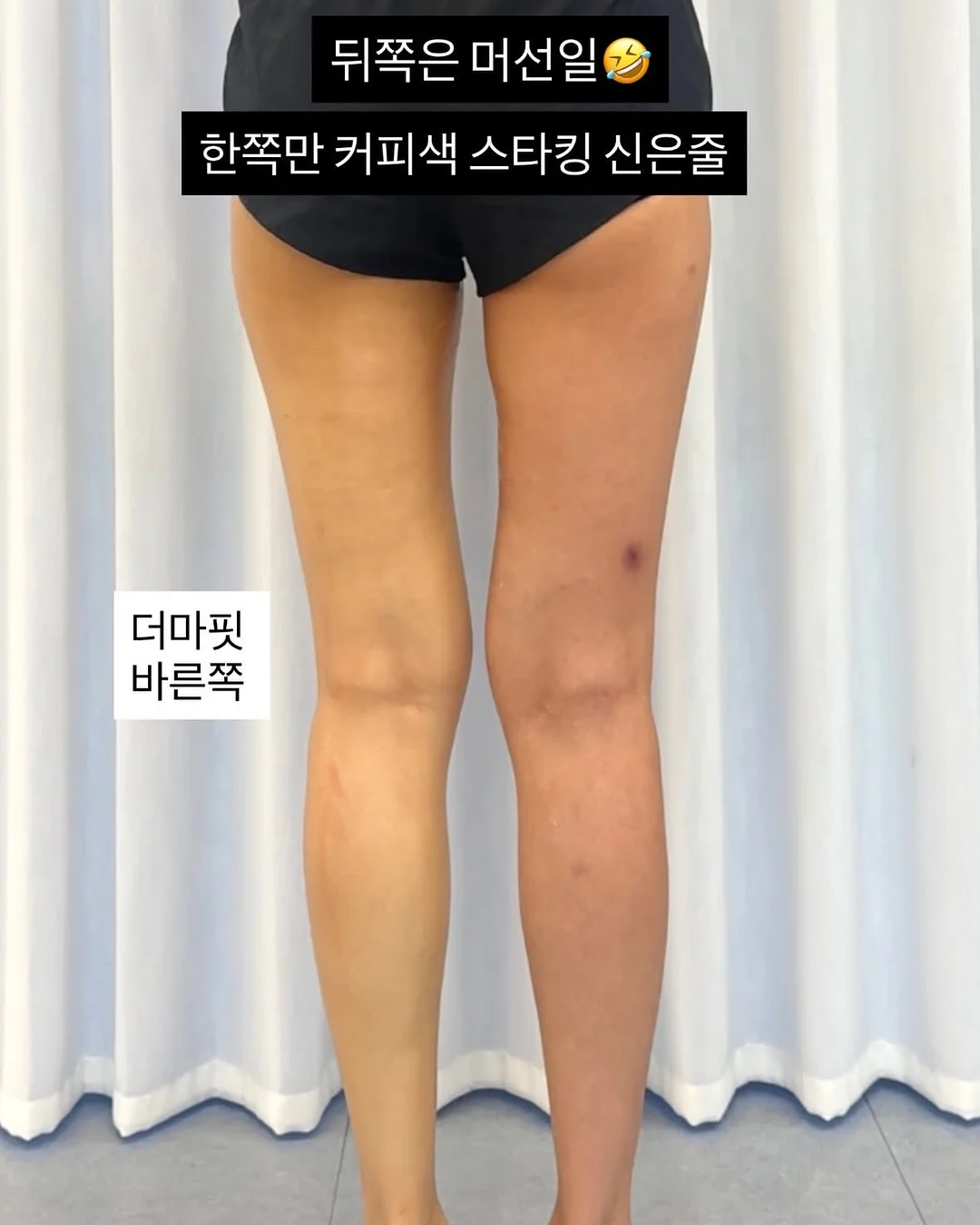 무늬 알리고무나무 10