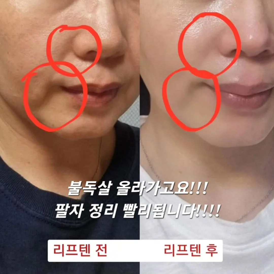 풀무원 디자인밀 식단관리 11