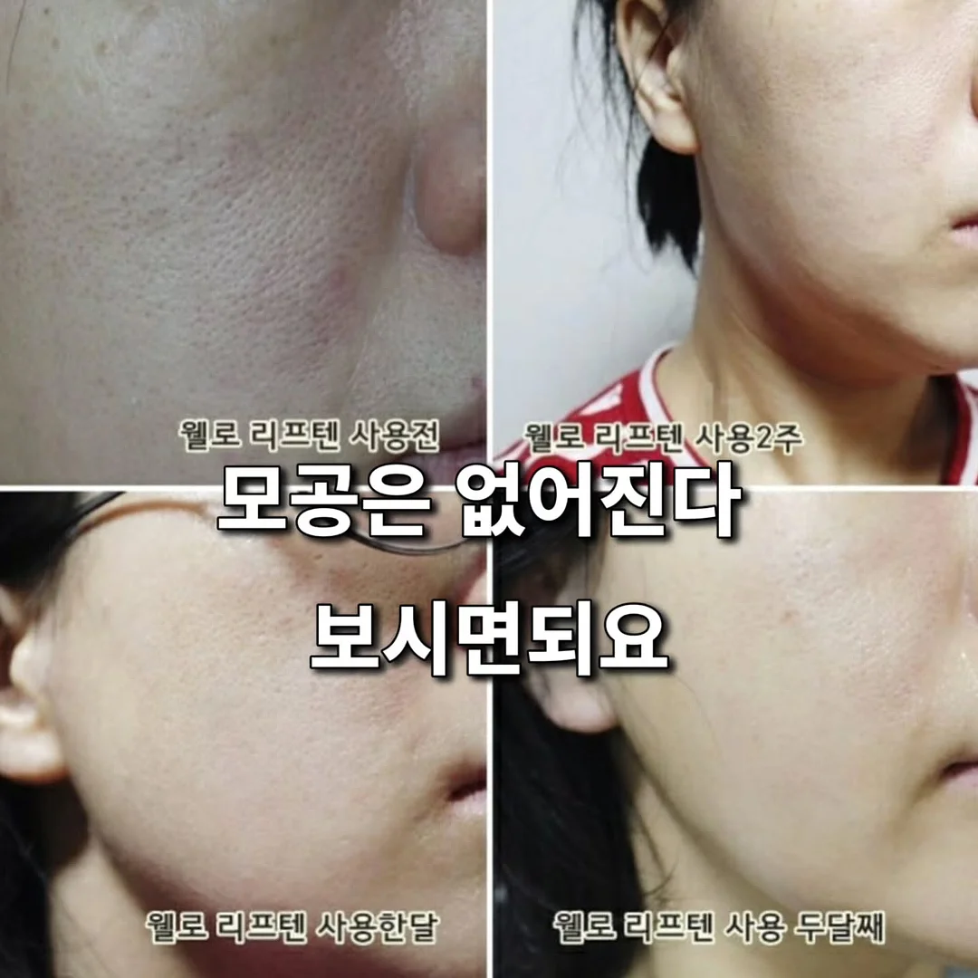 풀무원 디자인밀 식단관리 17