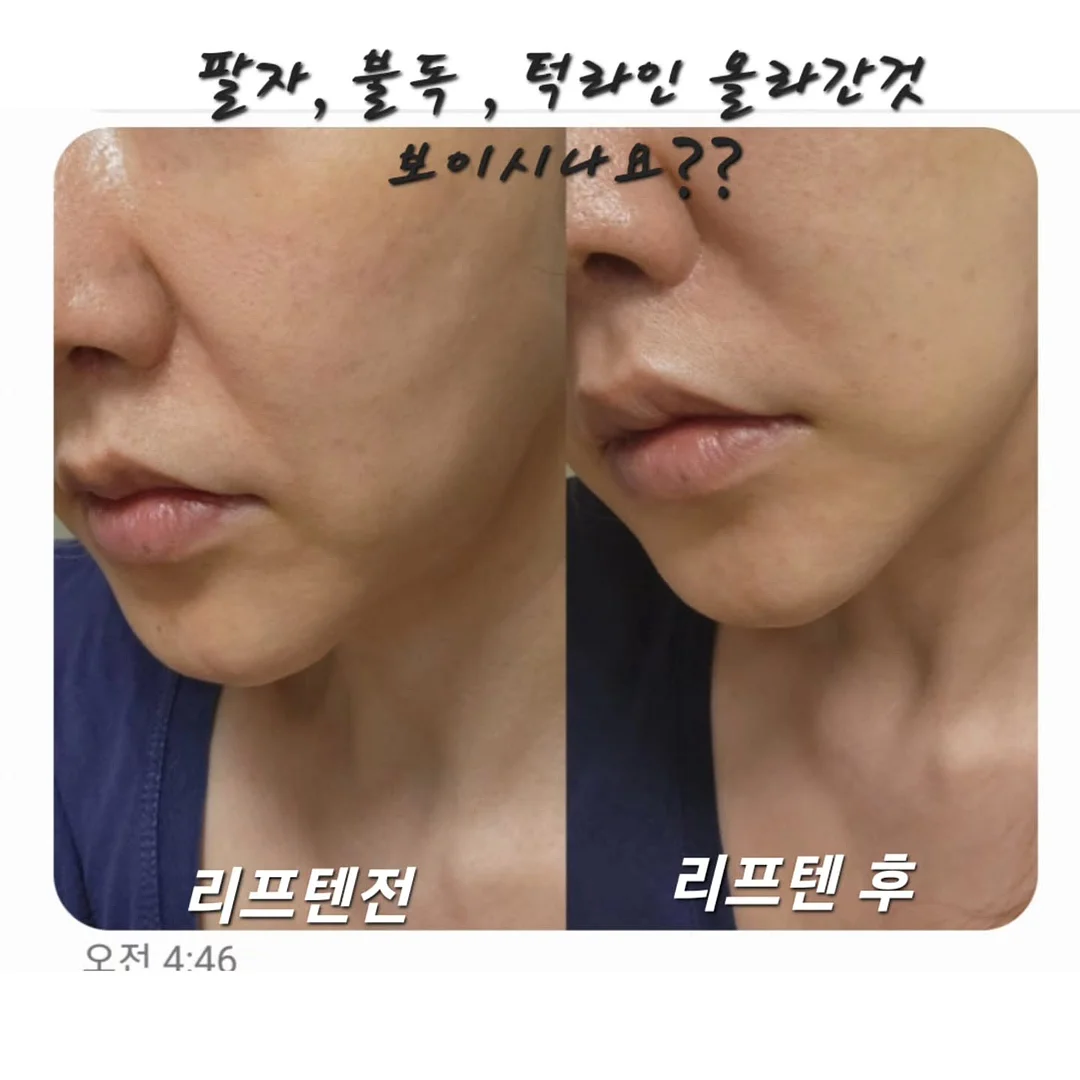 풀무원 디자인밀 식단관리 9