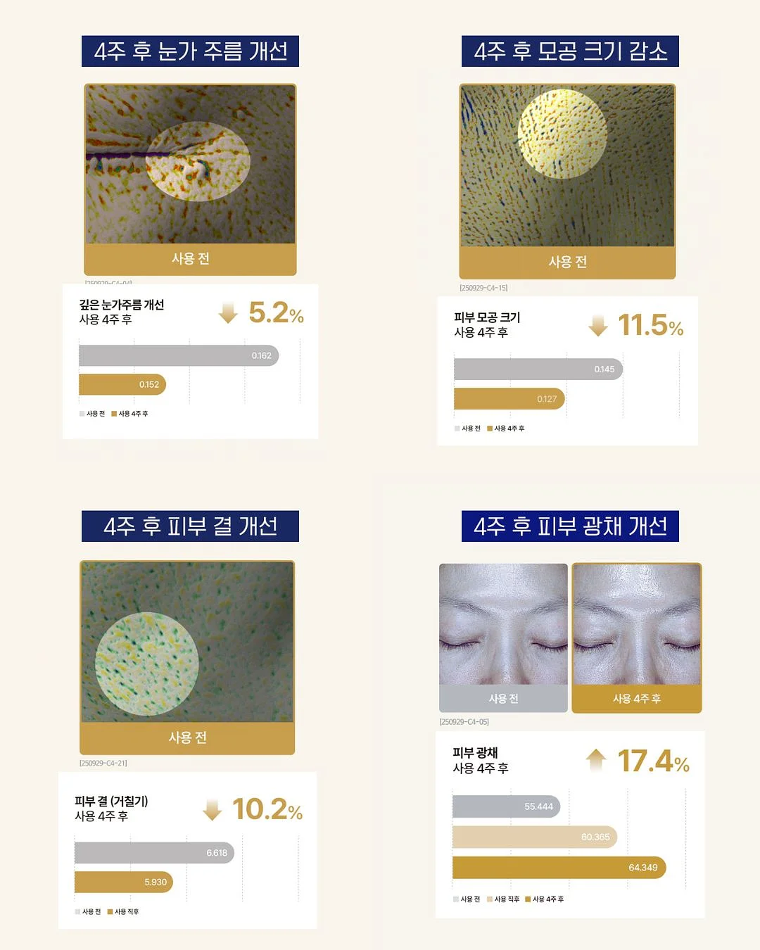 린넨 셔츠 10