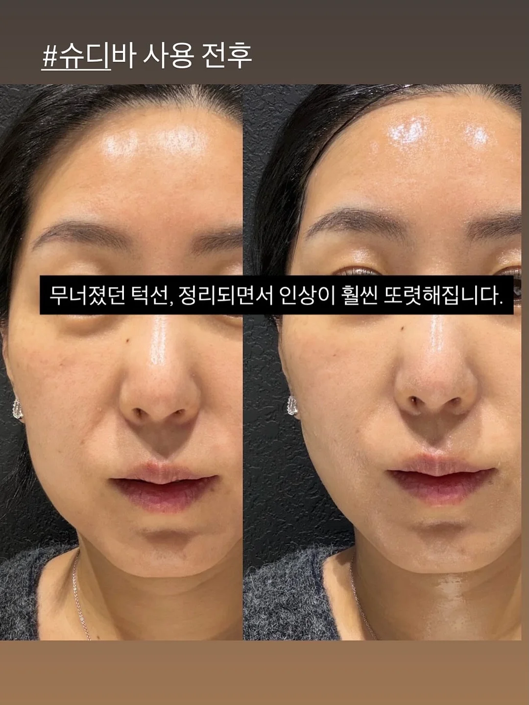 스텐 야채 보관함 13