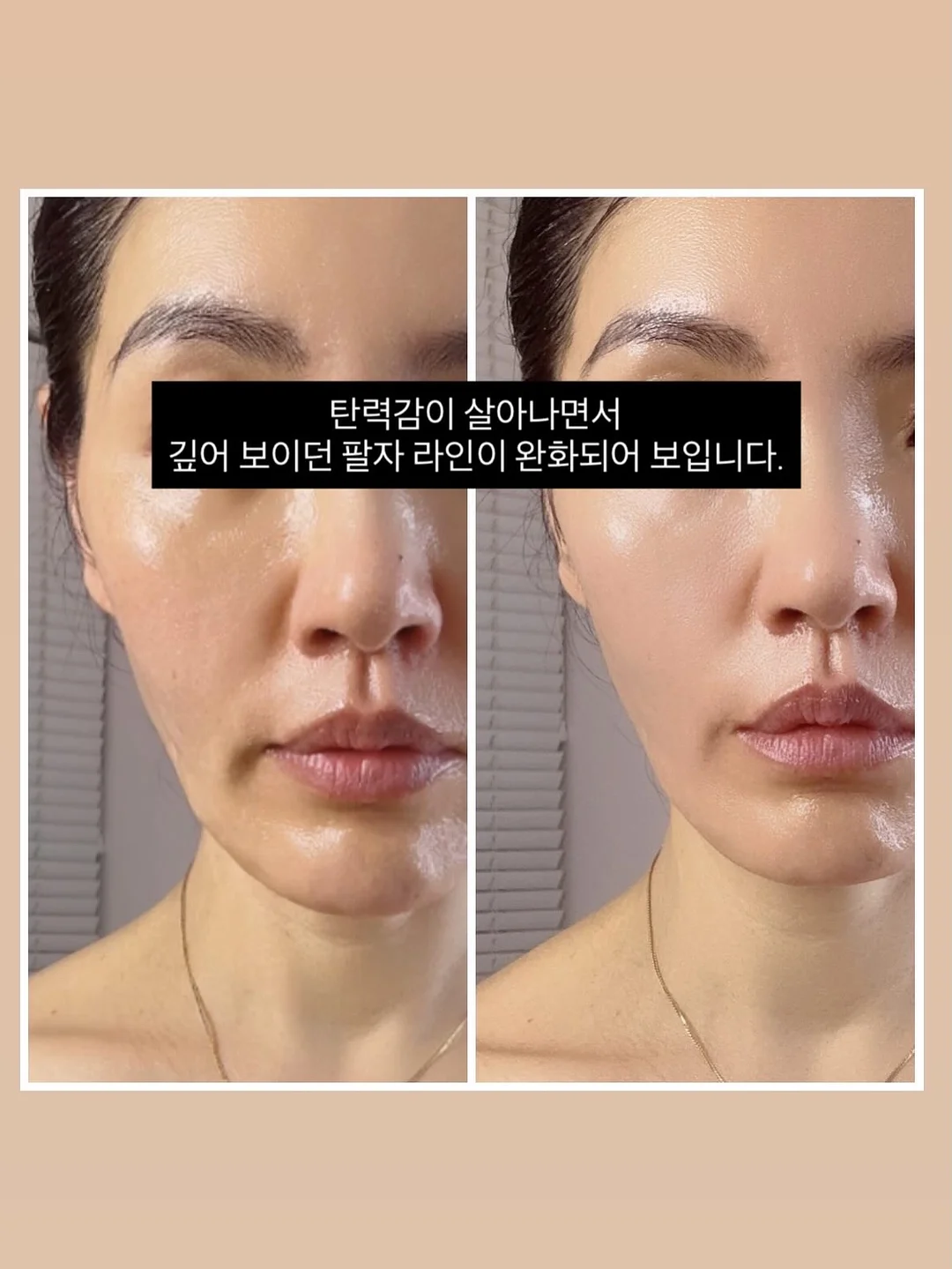 스텐 야채 보관함 14
