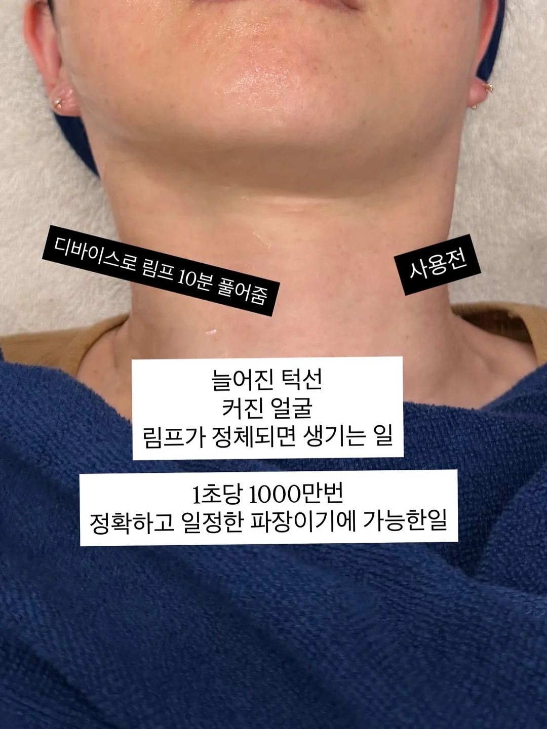 스텐 야채 보관함 10