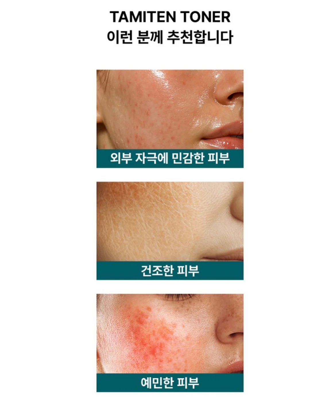 뉴발란스 명품 콜라보 라인 신발 2