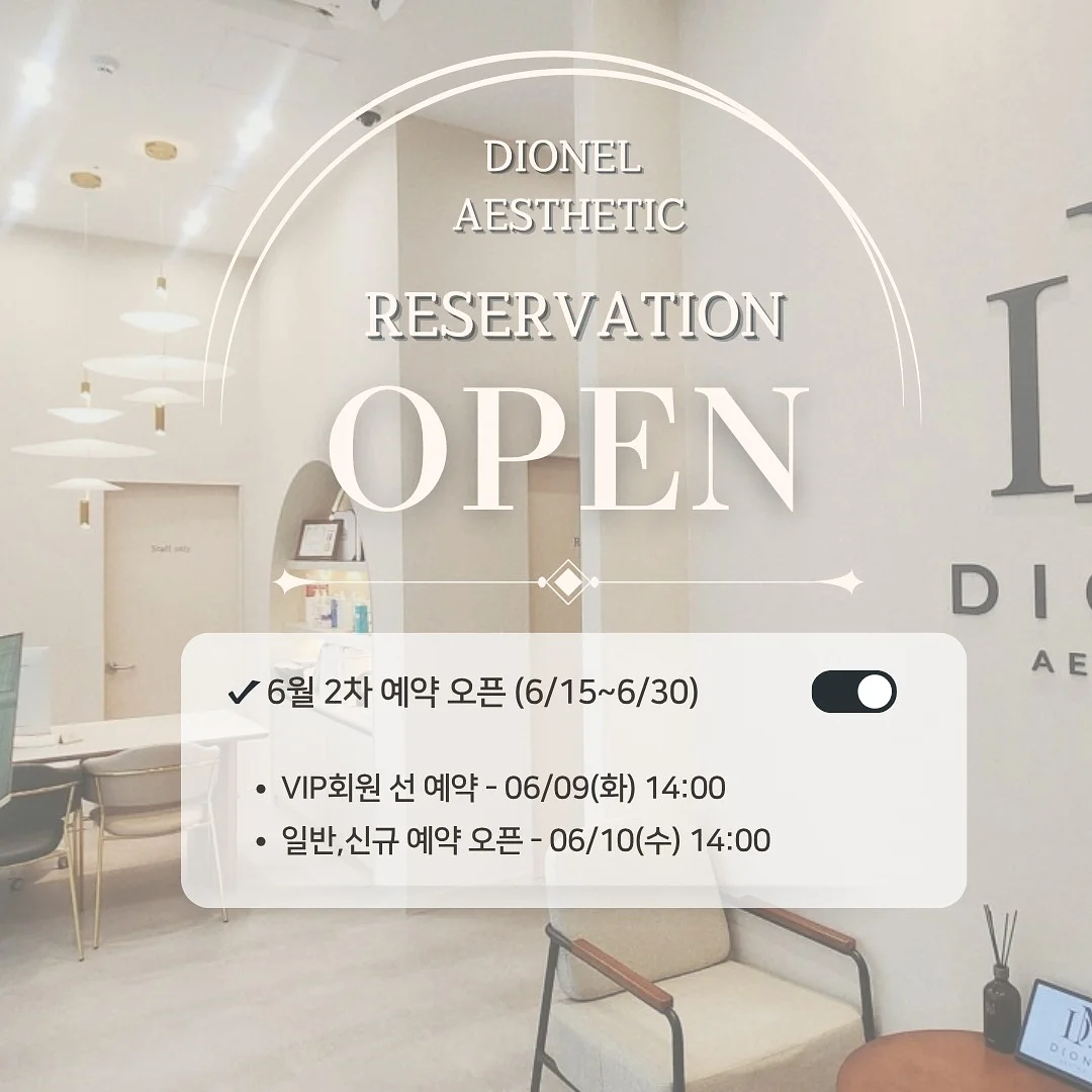 B필러 몰딩