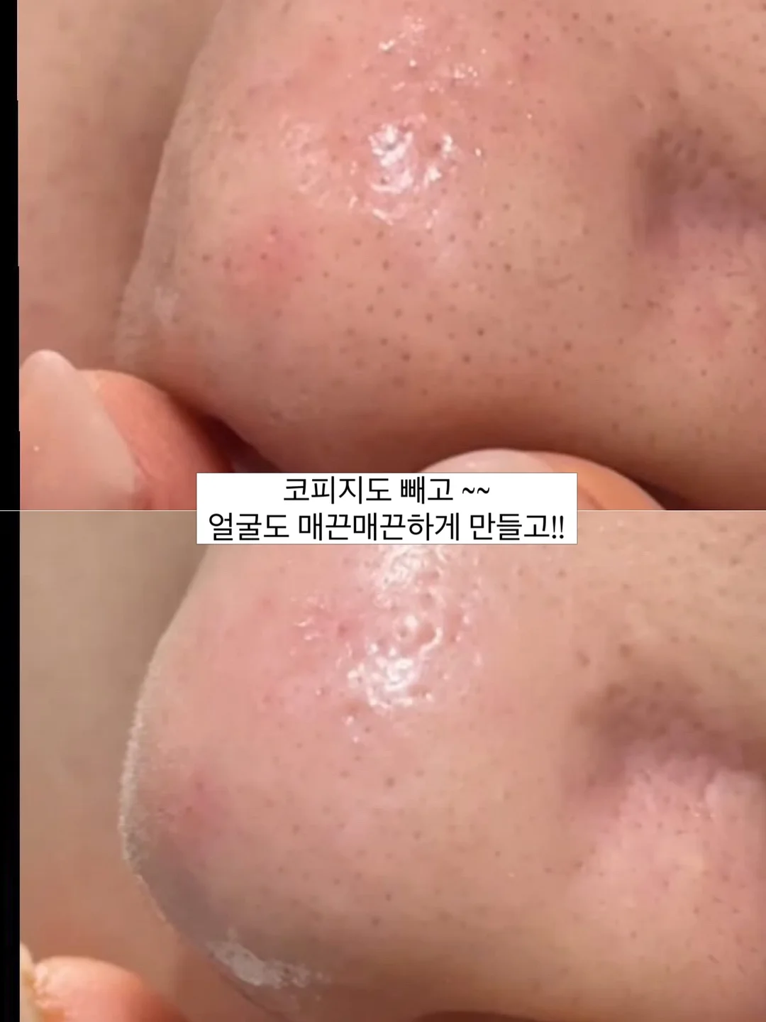 산소건+액티베이터+비타C세럼 세트 4