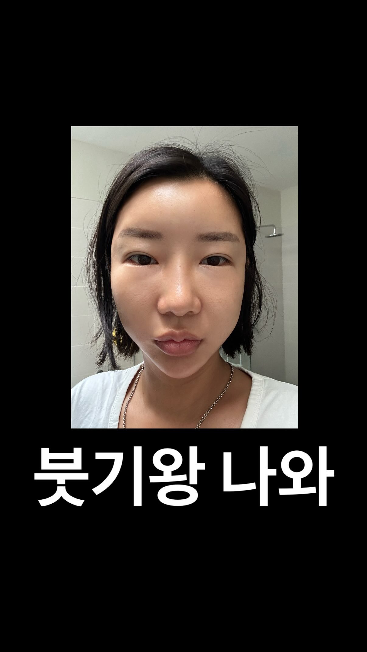 브로리코 액티브