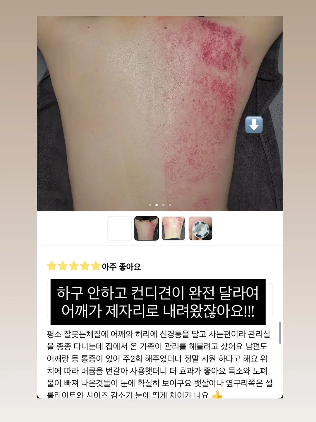 식혜 15
