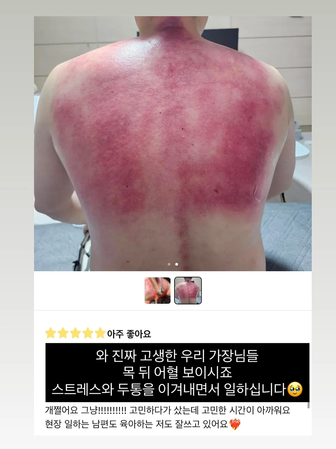 식혜 17