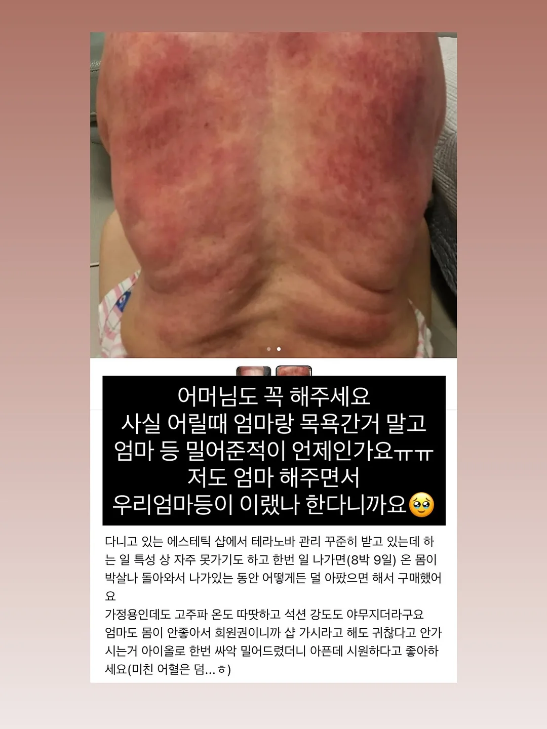식혜 20