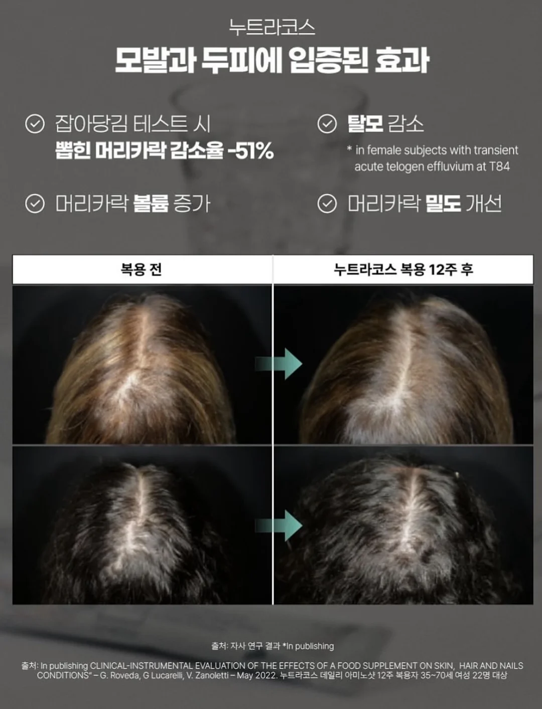 발레 스니커즈 18