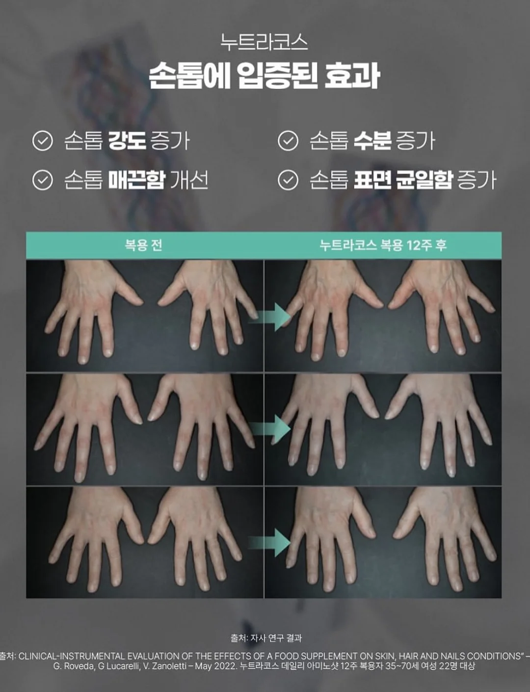 발레 스니커즈 19
