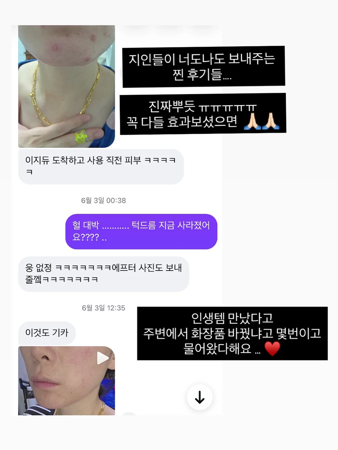 닥터오라클 레티노타이트닝 앰플 12