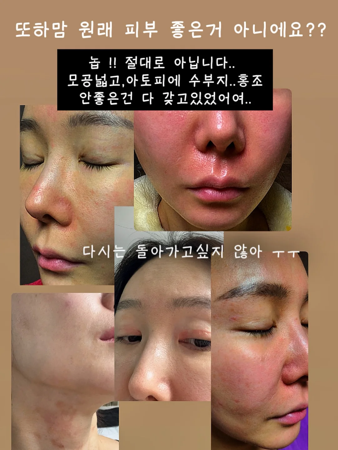 닥터오라클 레티노타이트닝 앰플 13