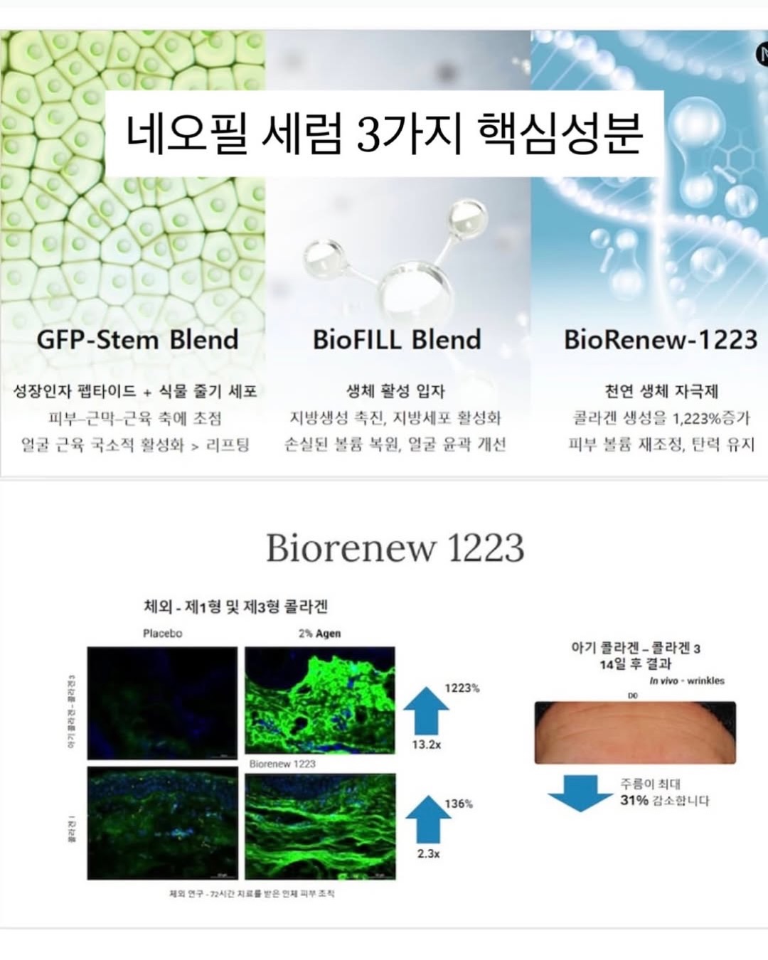 폰스트랩 8