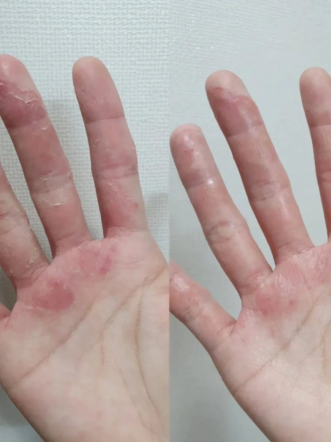 요기요 토스 무제한 3천쿠폰 12