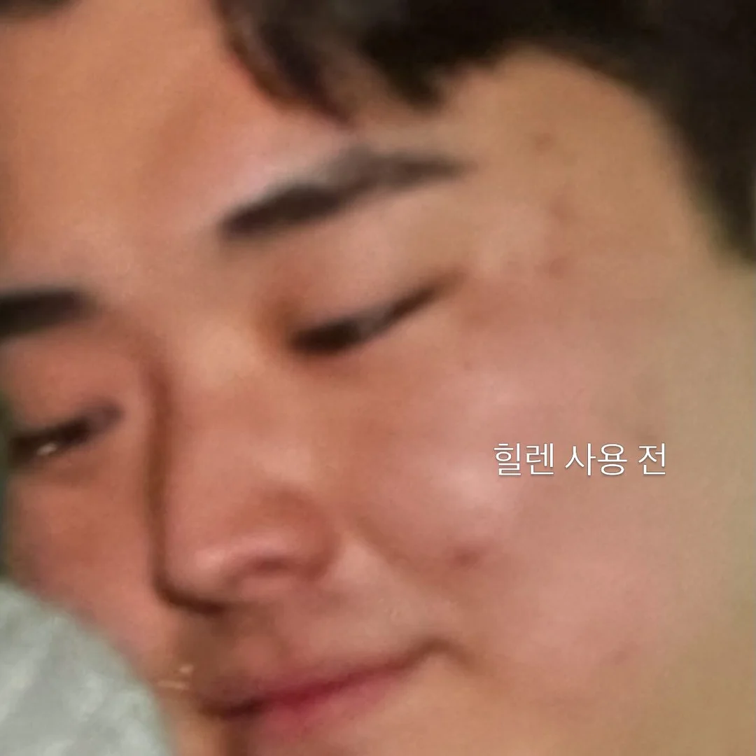 샤샤 집게핀, 하트 집게핀 5