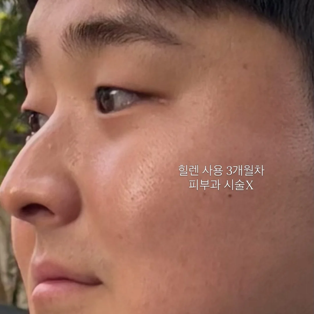 샤샤 집게핀, 하트 집게핀 6
