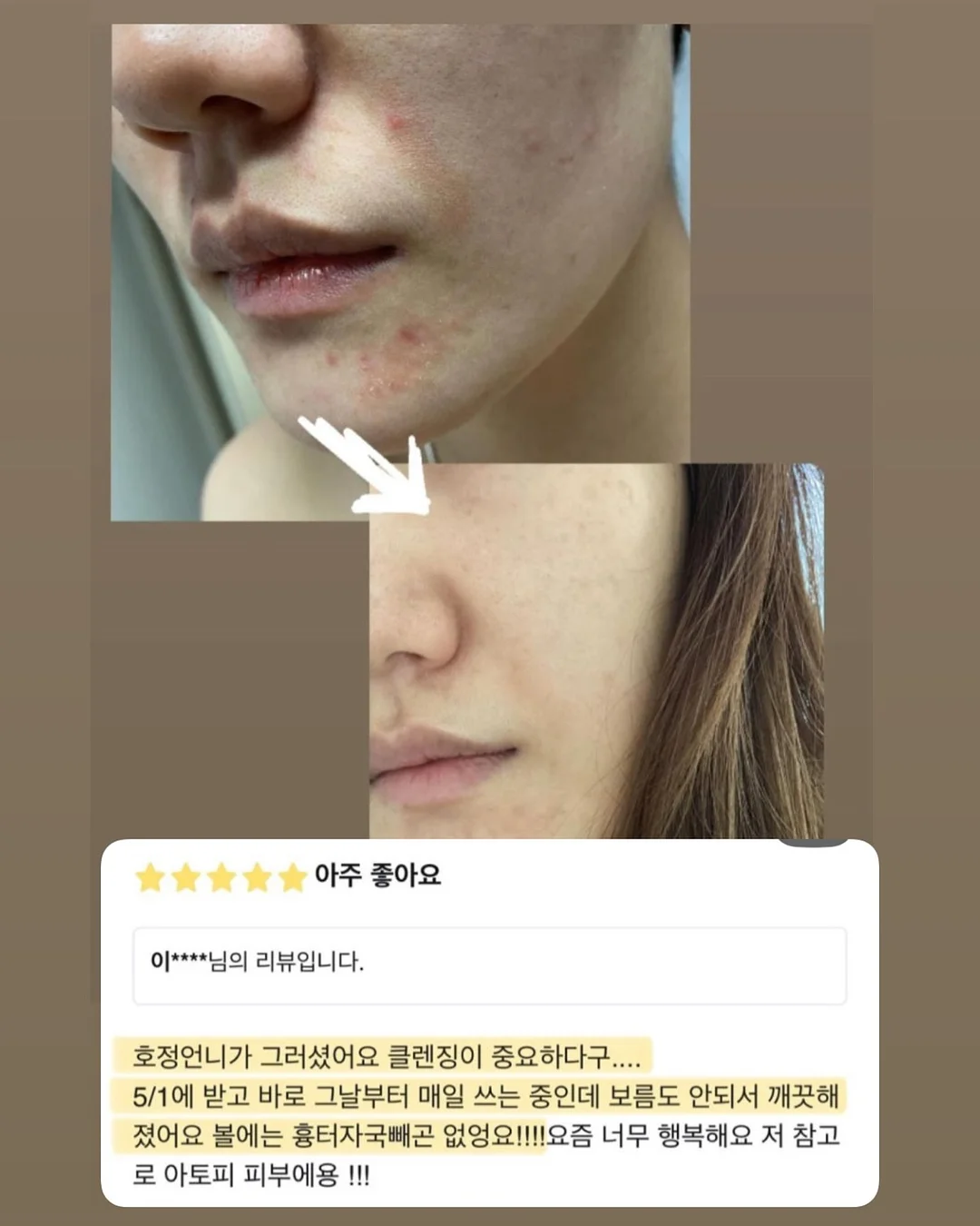 키즈스콜레 여름방학 레벨 업 8종 11
