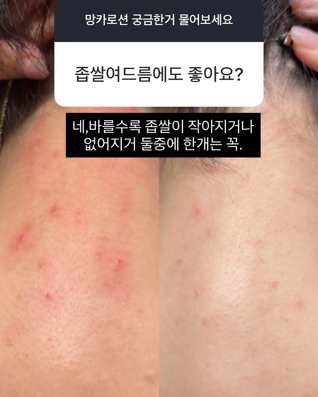 올리 바디브러쉬 1