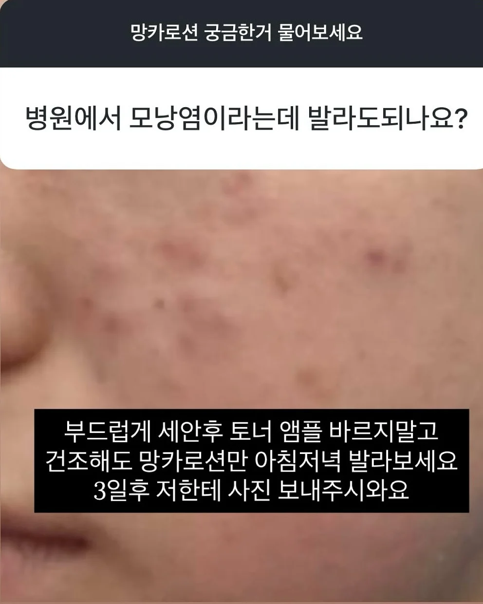 올리 바디브러쉬 2