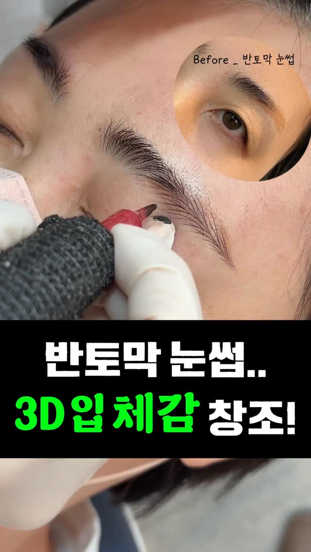 멜라셀 2주 패키지
