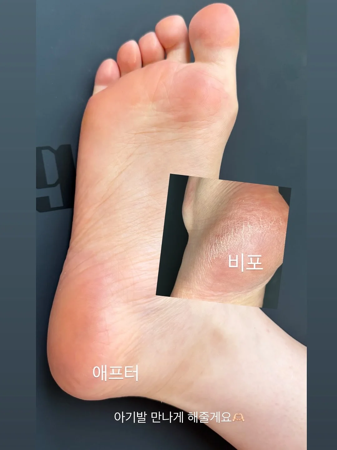 그린핑거 베베그로우 퓨어베이비 PA 젖병 1