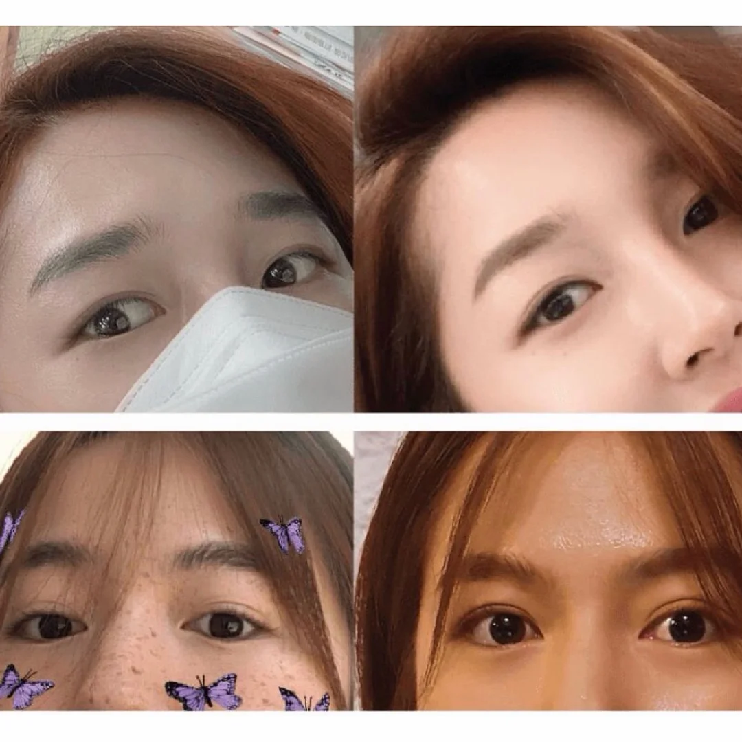 런요구르트 90일분 3