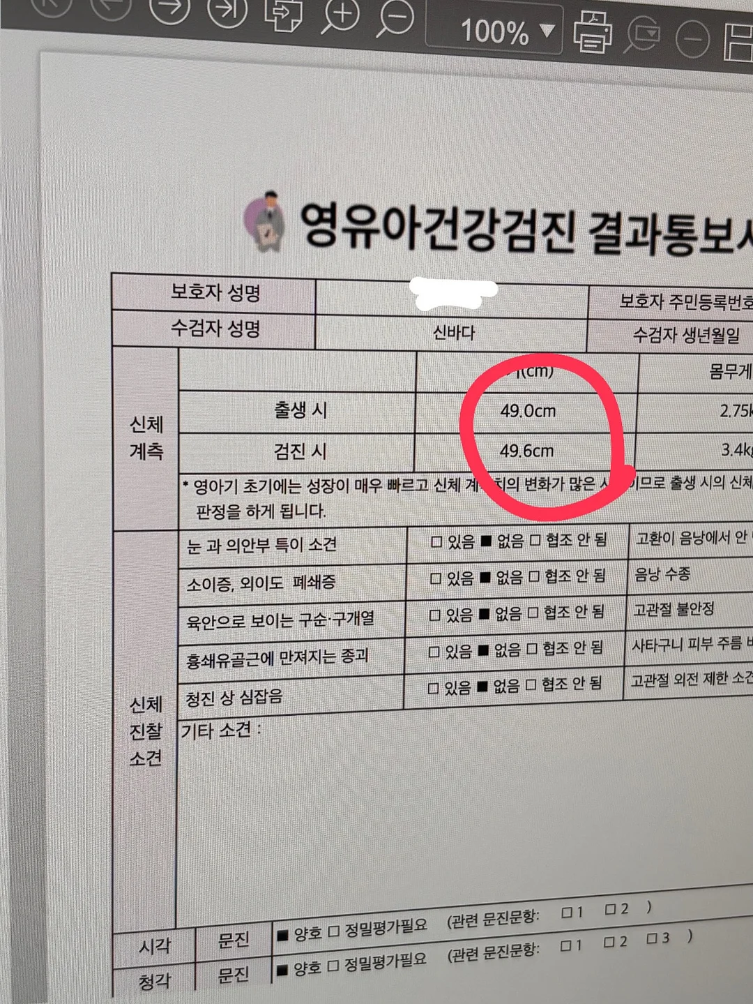 버치트리 워터겔 마스크팩 11