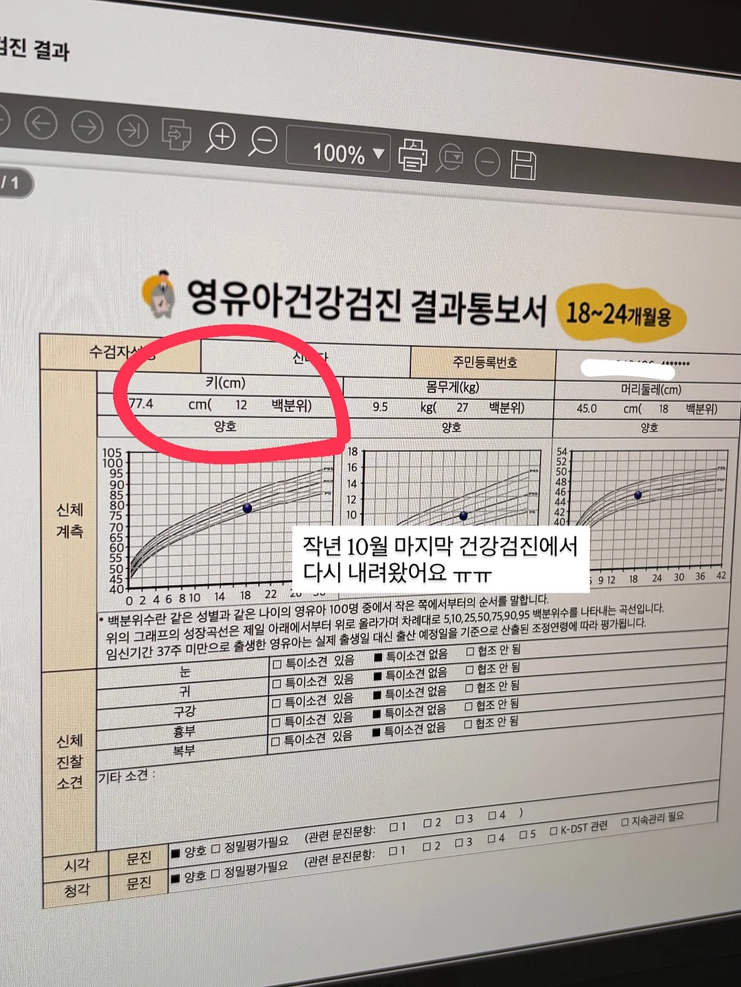 버치트리 워터겔 마스크팩 14