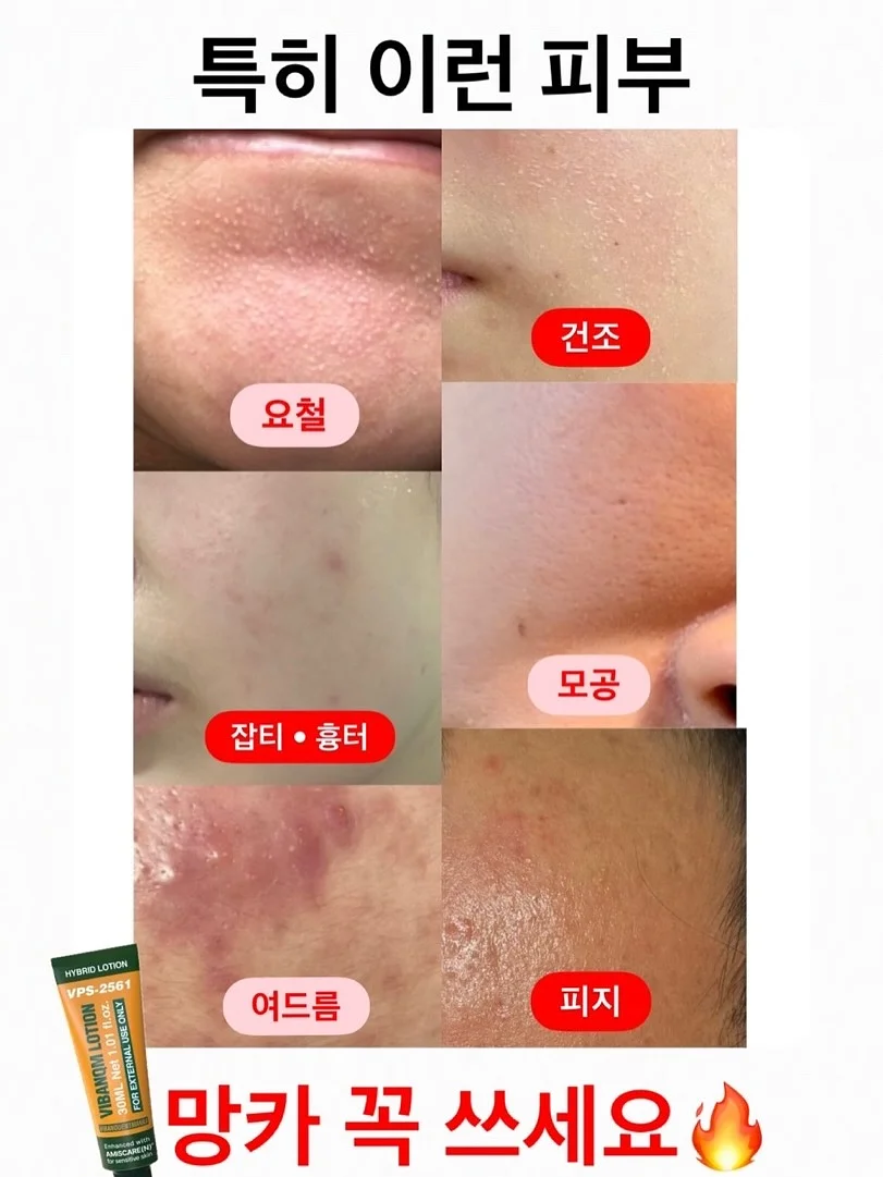 클래식 솔리테어 쥬얼리세트 9
