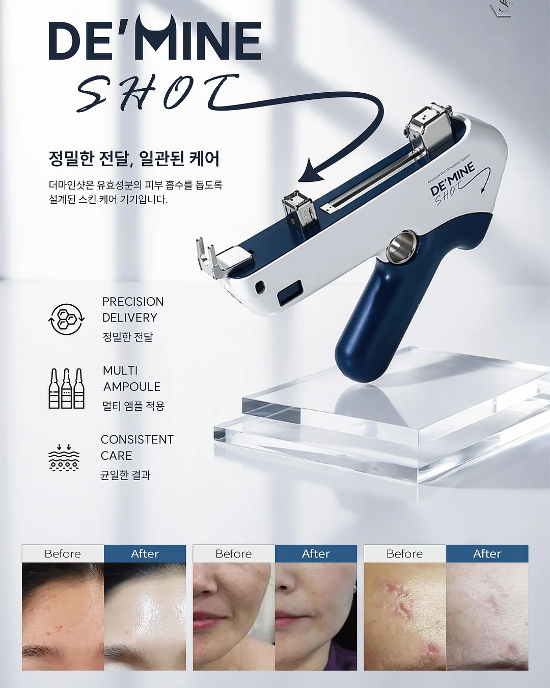 플리츠 반팔 2