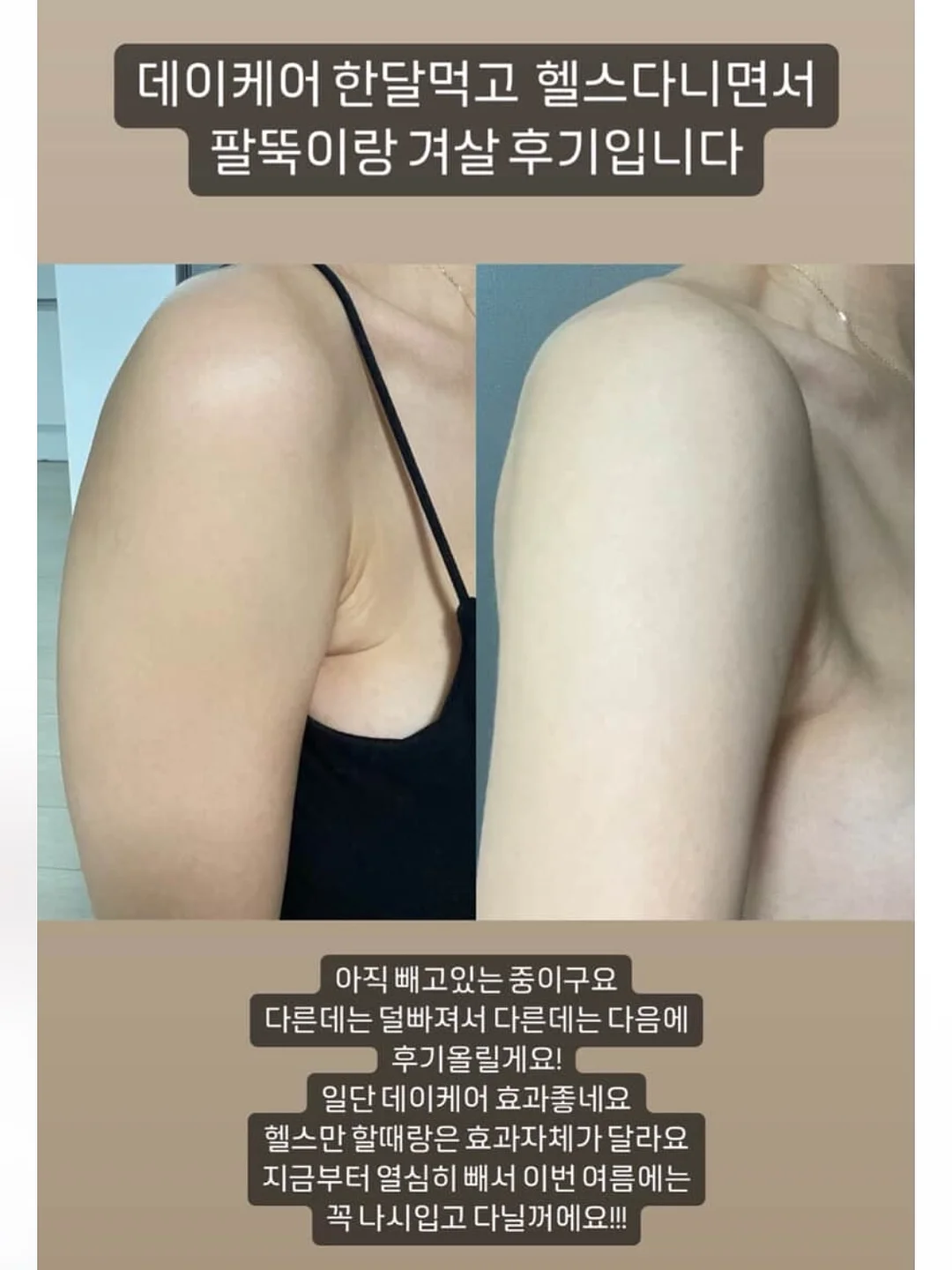 하트링 + 블루밍플라워 왕꽃치발기 3