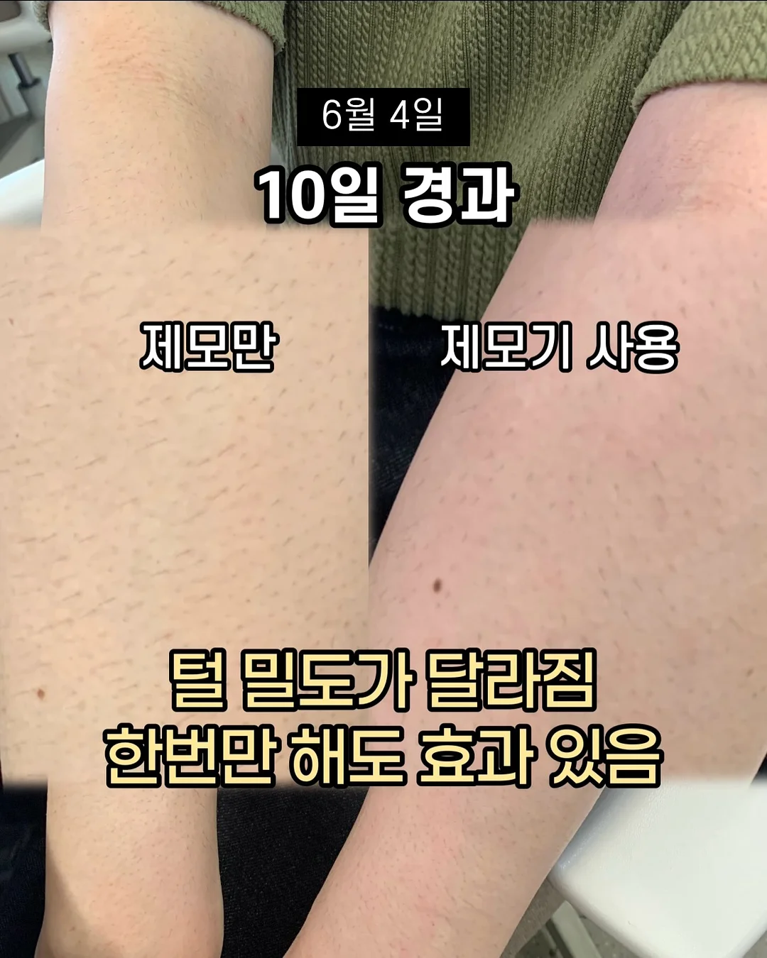 킹크랩 19