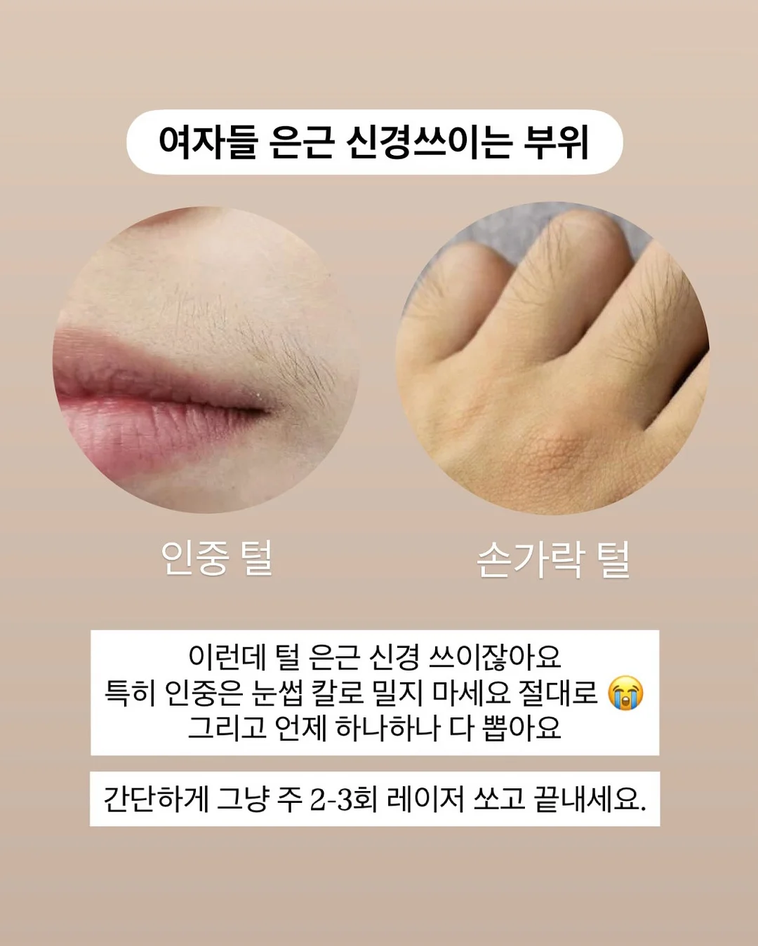 킹크랩 4