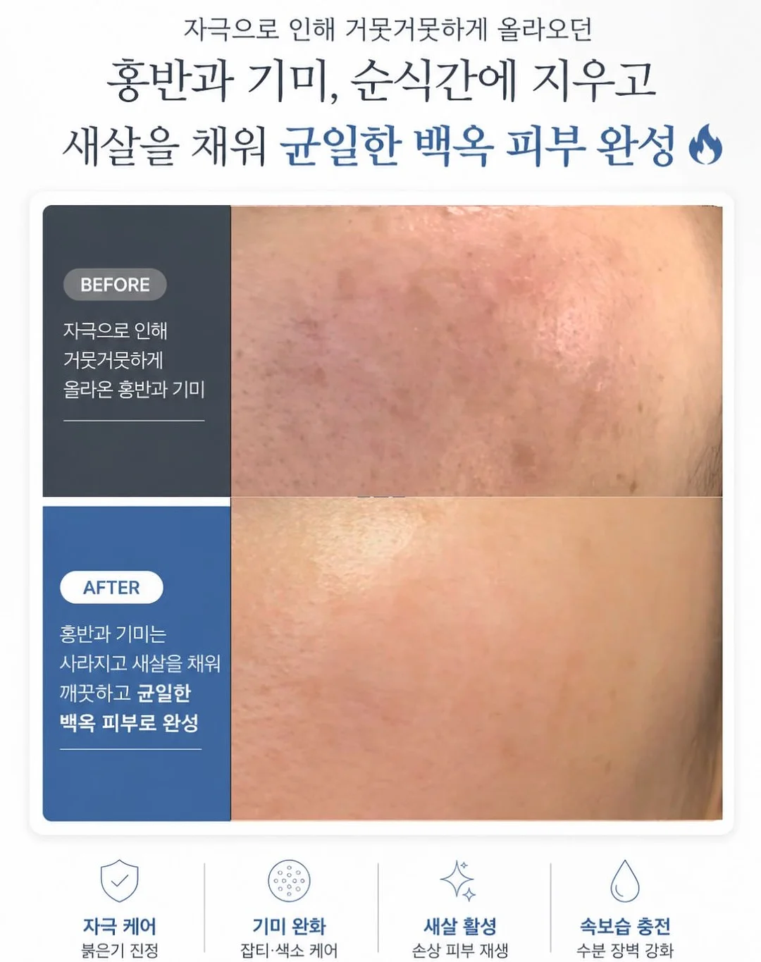 애플몬 요루 블라우스&팬츠 세트 2